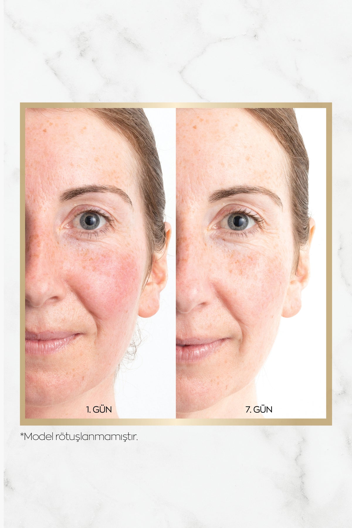 Avon Anew Renewal Power Serum 30 Ml. İkili Set