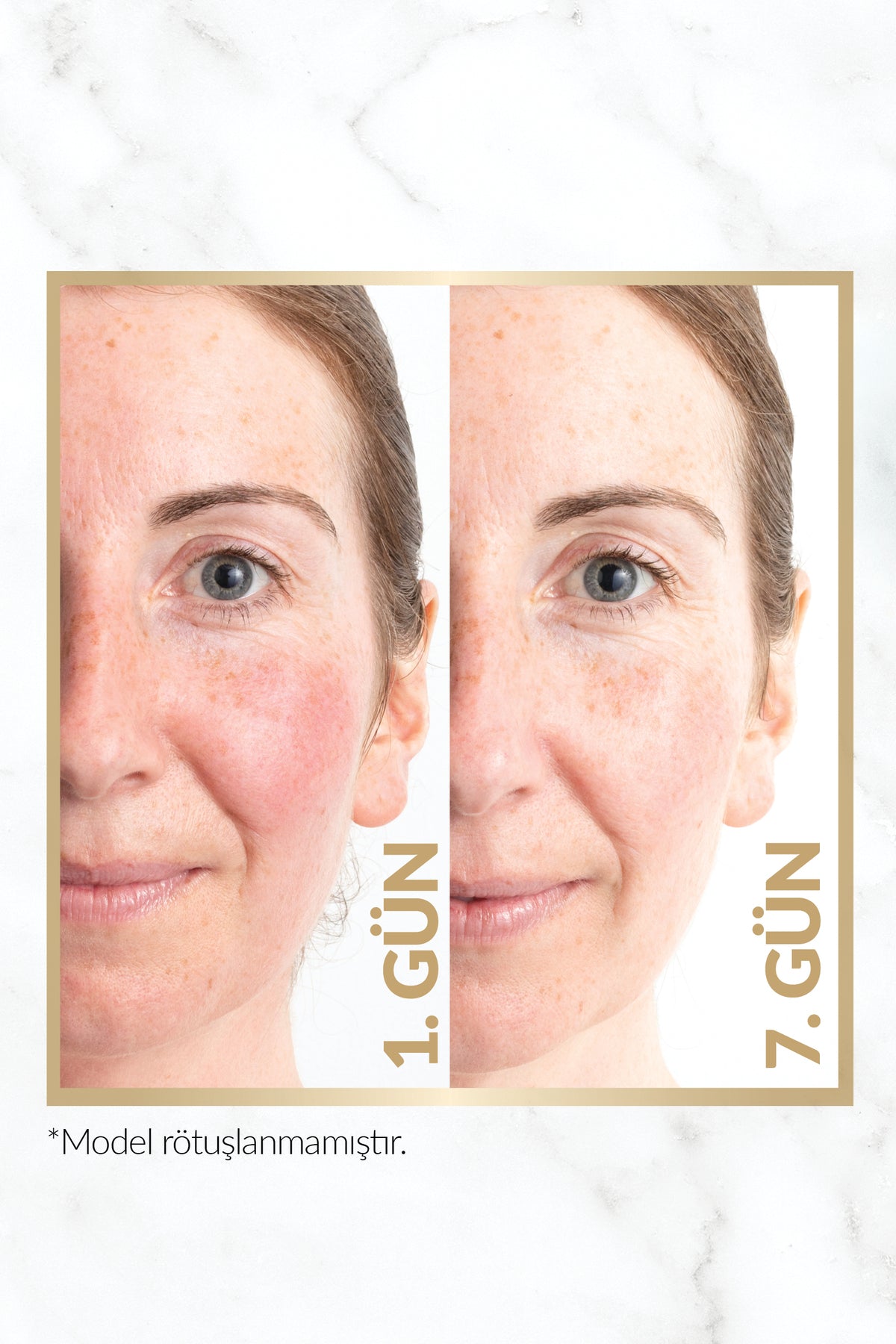 Avon Anew Renewal Power Serum 30 Ml.