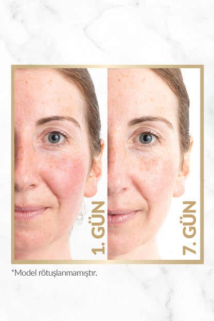 Avon Anew Renewal Power Serum 30 Ml.